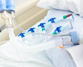 Ein Patient im Krankenhausbett mit mehreren medizinischen Schläuchen und Geräten, die an eine Atemmaske und andere medizinische Vorrichtungen angeschlossen sind. Die Umgebung ist klinisch und steril.